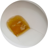 Urina turva ou escura